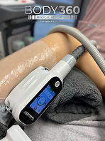 Fat Freezing and Body Contouring Cape Town.jpg