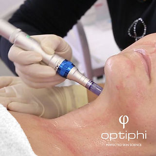 Micro-needling Melkbosstrand Cape Town Medical Grade Optiphi