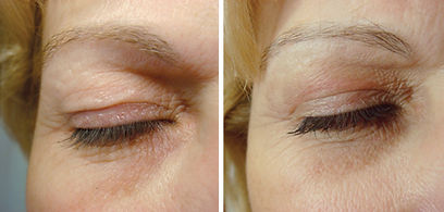 before-after-11.jpg