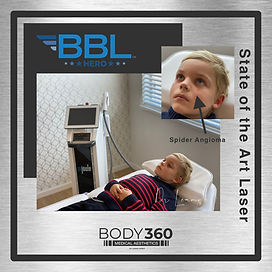 best laser in cape town bbl hero melkbosstrand.jpg