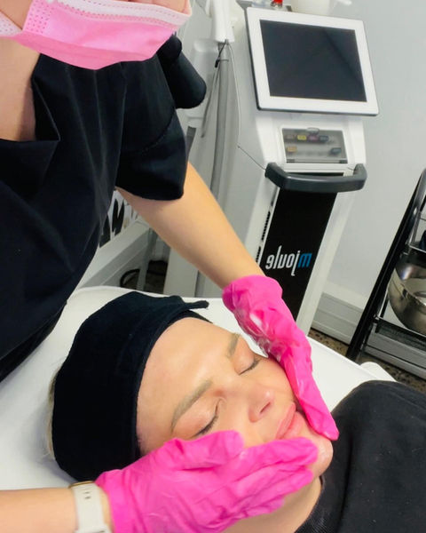 Dermaplaning Cape Town