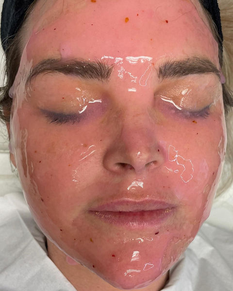 Dermaplaning Cape Town