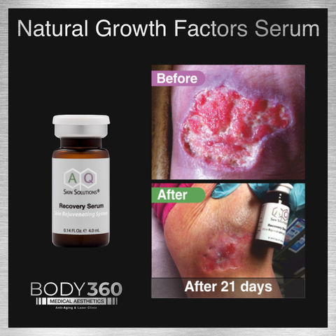 Treat a Wound highest concentration of natural growth factors Serum AQ Skin Solution’s Ski