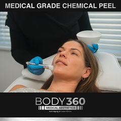 Retinol Peel cape town big bay melkbosstrand copy 2.jpg