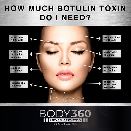 how much botox do i need cape town body 360 medical aesthetics Big Bay clinic