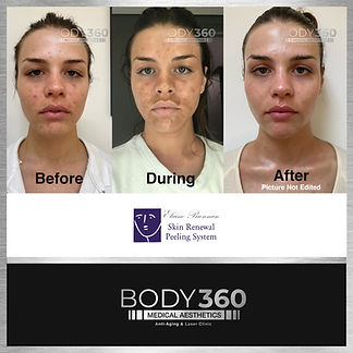 sElaine Brennan kin renewal Body 360.jpg