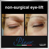 the plexr non-surgical eye-lift cape town.jpg